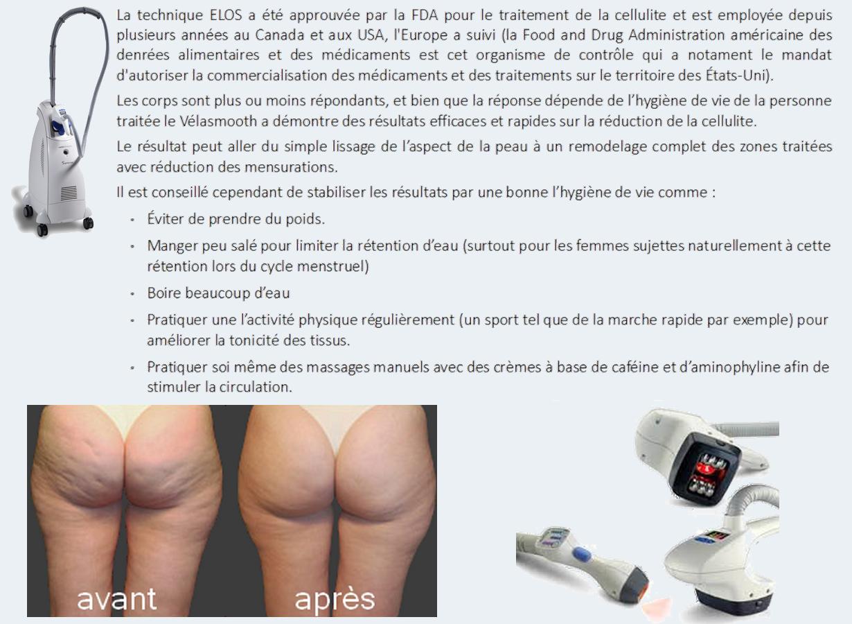 Résultats attendus du Vélasmooth