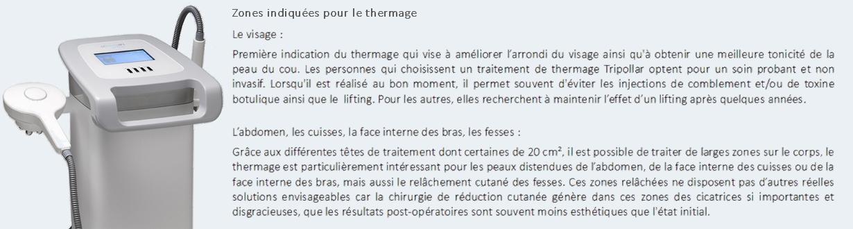 Zones indiquées pour le thermage Tripollar